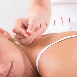 Chiropractic Amarillo TX Acupuncture